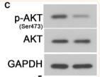 Phospho-AKT1/2/3 (Ser473) Antibody - FIGURE 3
MiR‐19b‐3p overexpression suppressed autophagy via binging to PTEN.