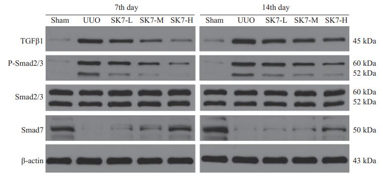 TGF beta 1 Antibody - Fig.