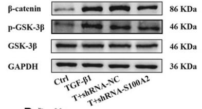 Phospho-GSK3 beta (Ser9) Antibody - FIG.