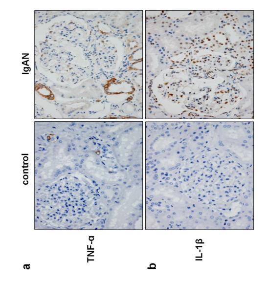 IL1 beta Antibody - Fig.