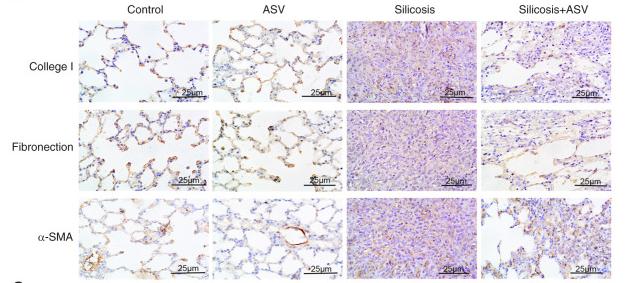 Collagen I Antibody - Figure 3
ASV treatment reduces the expressions of Collagen I, fibronectin and α-SMA.