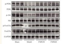 PI3K p85 alpha Antibody - FIGURE 5
FMN inhibits myostatin‐mediated dephosphorylation on the PI3K/Akt/FoxO3a signalling pathway in the muscle of CKD rats and C2C12 myotubes.