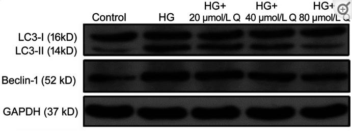LC3A/B Antibody - Figure 6
The relative expressions of LC3 and Beclin-1 of HRMECs by Western blotting in different groups treated for 48h
HG: High glucose, Q: Quercetin.