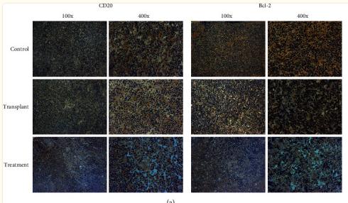 Bcl-2 Antibody - Figure 3
Immunohistological detection for the expression and distribution of CD20, Bcl-2, Bcl-6, and Ki67 in tumor area of mice in each group.