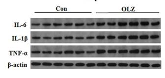 IL6 Antibody - FIGURE 11
Effects of 8-day (A), pair-feeding (8-day) (B), and 36-day (C) olanzapine treatment on the IL-6, IL-1β, and TNF-α levels in plasma.