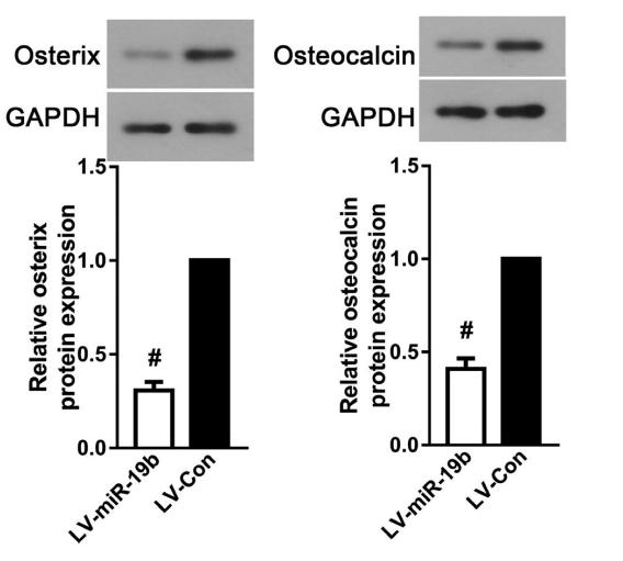 Osteocalcin Antibody - FIGURE 2|MiR-19b-3p overexpression inhibited osteogenic differentiation of BMSCs.