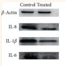IL1 beta Antibody - Figure 3
The expression of IL-6, IL-8, IL-1β, and TNF-α mRNA and protein in the endometriotic tissue of different groups.