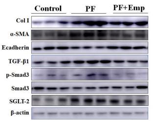TGF beta 1 Antibody - Fig.