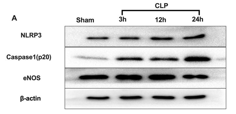 Cleaved-Caspase 1 (Asp296), p20 Antibody - Fig.