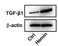 TGF beta 1 Antibody - Figure 4
Regulatory effect of TGF-β1 on the expression of SERPINE1 in HT22 cells.