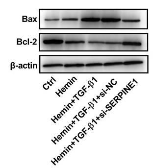 Bcl-2 Antibody - Figure 5
SERPINE1 knockdown attenuates the effect of TGF-β1 on hemin-induced neuronal damage.