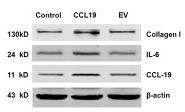 IL6 Antibody - Figure 2
Effects of CCL19 on VSMCS inflammation, ECM deposition, proliferation and migration.