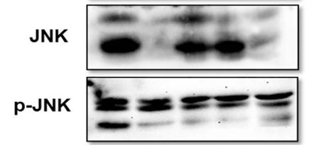 Phospho-JNK1/2/3 (Thr183+Tyr185) Antibody - Fig 4
Pathways involved in the regulation of T.