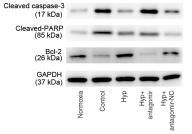 Cleaved-PARP (Asp214) Antibody - Figure 2.