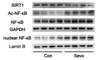 NF-kB p65 Antibody - Fig.