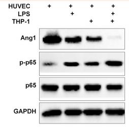 NF-kB p65 Antibody - Figure 3
THP-1-derived macrophages regulate Ang1 and NF-κB pathways in HUVECs.