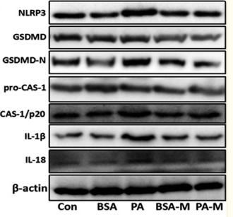 NLRP3 Antibody - FIGURE 8
MSCs ameliorated hepatic cell death through inhibiting pyroptosis.