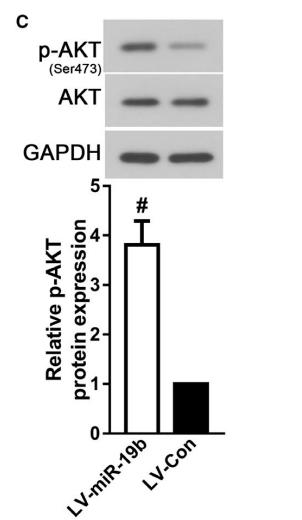 Phospho-AKT1/2/3 (Ser473) Antibody - FIGURE 3|MiR-19b-3p overexpression suppressed autophagy via binging to PTEN.