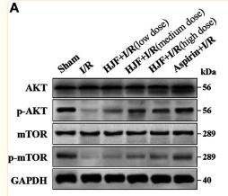 Phospho-AKT1/2/3 (Ser473) Antibody - FIGURE 7
Effects of HJF on the PI3K/AKT/mTOR signalling pathway.