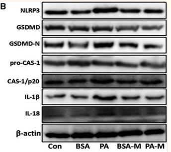 Cleaved-IL-1 beta (Asp116) Antibody - FIGURE 8
MSCs ameliorated hepatic cell death through inhibiting pyroptosis.