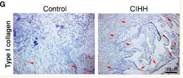 Collagen I Antibody - Figure 6
Bone formation.