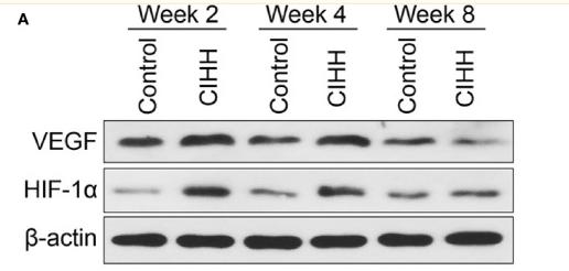 HIF1A Antibody - Figure 4
Angiogenesis.