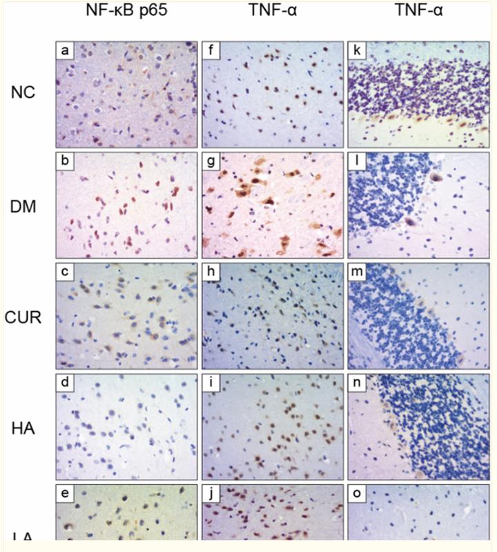 TNF alpha Antibody - Fig.