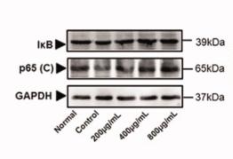NF-kB p65 Antibody - Figure 10.