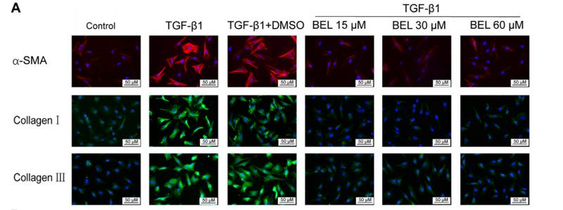Collagen I Antibody - FIGURE 4 | BEL decreases the expression of α-SMA, collagen Ⅰ, and collagen Ⅲ induced by TGF-β1 in CFs (A) The effects of different doses of BEL (15, 30, 60 μM)on α-SMA, collagen Ⅰ, and collagen Ⅲ expression induced by TGF-β1 using immunofluorescence staining.