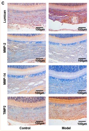 MMP2 Antibody - Figure 2
Expression of lumican, MMP-2, MMP-14 and TIMP-2 in scleral tissue.