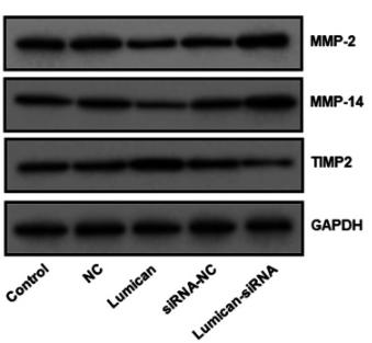 MMP2 Antibody - Figure 5
MMP-2, MMP-14 and TIMP-2 expression in rat scleral fibroblasts following lumican overexpression or knockdown.