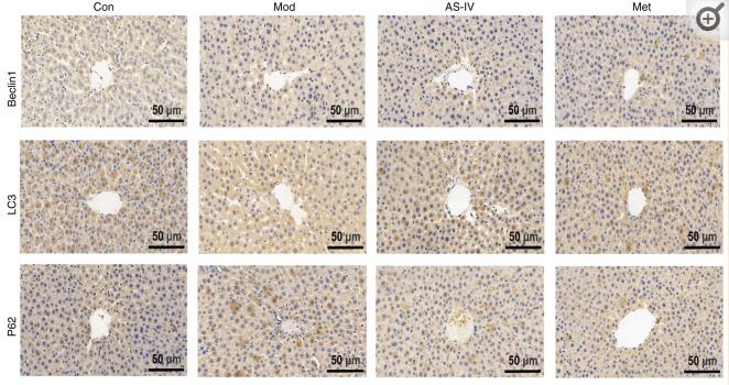 LC3A/B Antibody - Figure 6.