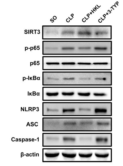 Caspase 1 Antibody - Fig.