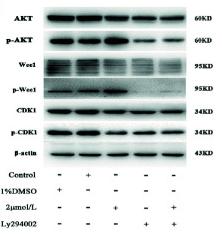 Phospho-AKT1/2/3 (Ser473) Antibody - Figure 4
High iodine induced the proliferation of BCPAP and 8305C cells via activating AKT-mediated Wee1/CDK1 axis.