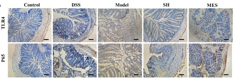 NF-kB p65 Antibody - FIGURE 6 The protein levels of Dectin1, TLR2, TLR4, and their associated downstream effector NF-κBp65 are declined post sodium
houttuyfonate (SH) management.
