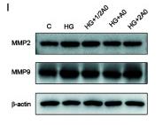 MMP2 Antibody - Figure 2.