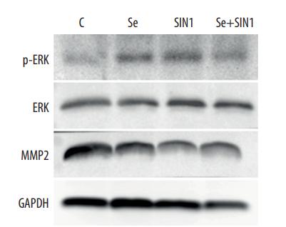 ERK1/2 Antibody - Figure 4.