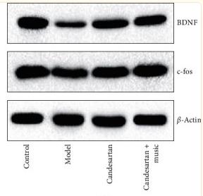 BDNF Antibody - Figure 6
Candesartan and music therapy promoted BDNF and c-fos in the hippocampus: (a) mRNA expression; (b) protein expression.