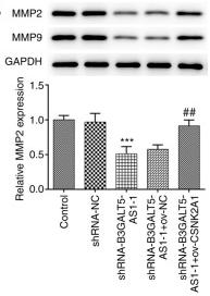 MMP2 Antibody - Figure 3
B3GALT5-AS1/CSNK2A1 axis regulates MKN-45 cell migration and invasion.