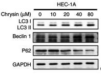 Beclin 1 Antibody - Figure 3
Concentration-dependent effect of chrysin affects the expression of the autophagy-related protein LC3II in endometrial cancer cells.