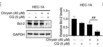 Bcl-2 Antibody - Figure 4
Chrysin induces cytoprotective autophagy in endometrial cancer cells.