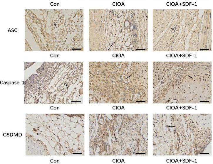 GSDMD Antibody - Fig.