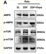 AMPK alpha Antibody - FIGURE 5
Dapagliflozin induces autophagy via the AMPK-mTOR pathway in vitro and in vivo.