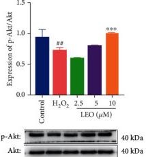 Phospho-AKT1/2/3 (Ser473) Antibody - Figure 8
Effect of LEO on protein expression of PI3K, p-PI3K, Akt, p-Akt, eNOS, and p-eNOS in HUVEC.