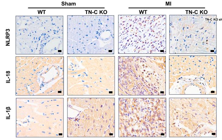 IL1 beta Antibody - Fig.
