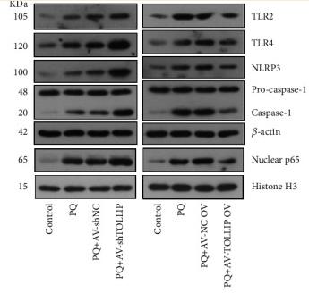 NF-kB p65 Antibody - Figure 5
Effect of TOLLIP knockdown and overexpression on the PQ-induced activation of NLRP3 inflammasome in HK-2 cells.