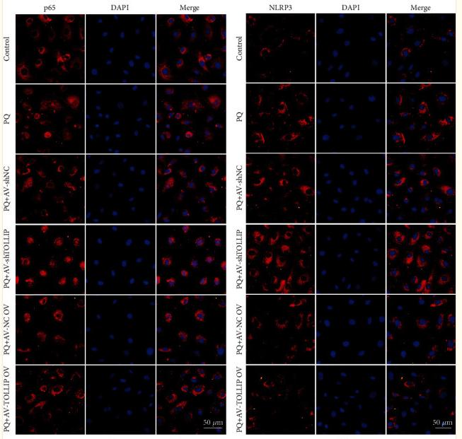 NF-kB p65 Antibody - Figure 5
Effect of TOLLIP knockdown and overexpression on the PQ-induced activation of NLRP3 inflammasome in HK-2 cells.