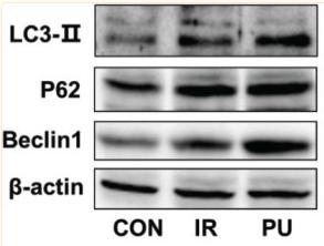 LC3A/B Antibody - Fig.