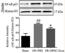 NF-kB p65 Antibody - FIGURE 3
Effect of DPSC‐Exos on the expression of TLR4, MyD88, NF‐κB p65 and HMGB1 on day 7 after cerebral I/R damage.
