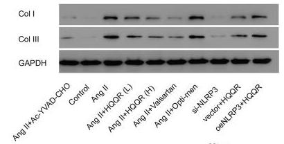 Collagen I Antibody - Figure 7.